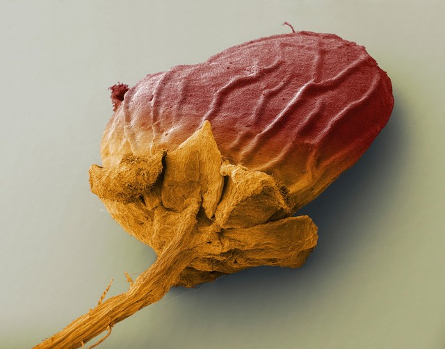 Drupaceous fruit from Cotinus coggygria (smoke bush), SEM