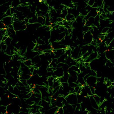 Cells infected with candida yeast, LM
