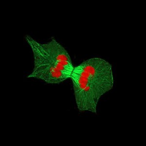 view Dividing HeLa cell, LM