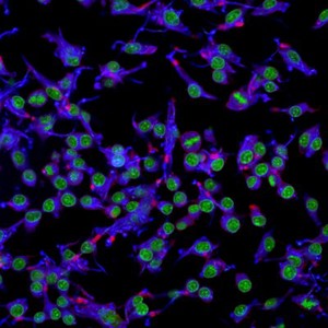 view Macrophages infected with candida yeast, LM