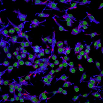 Macrophages infected with candida yeast, LM