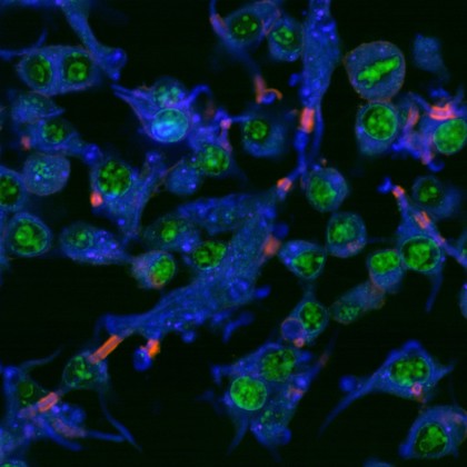 Macrophages infected with candida yeast, LM