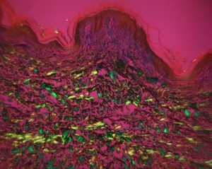 view Collagen fibres in human skin, LM