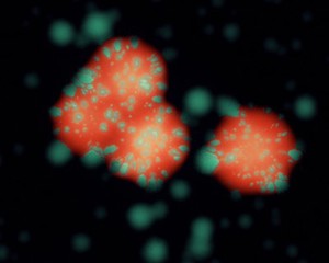 view Colonies of E. coli bacteria, LM