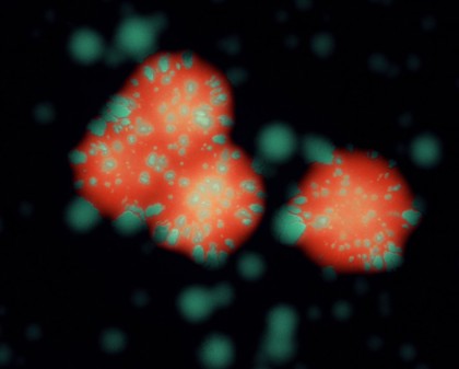 Colonies of E. coli bacteria, LM