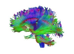 view Healthy human adult brain viewed from the side, tractography