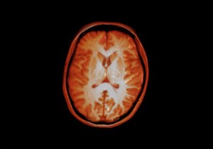 view Healthy adult human brain viewed from above, MRI