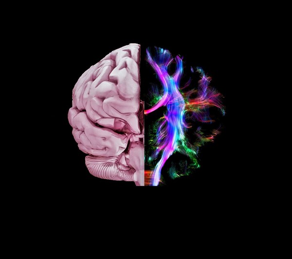 Healthy brain, composite of tractography and MRI