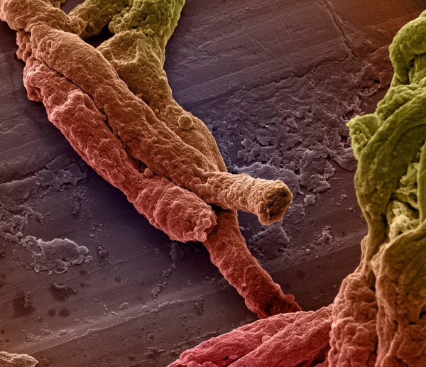 Mouse brain capillaries, SEM