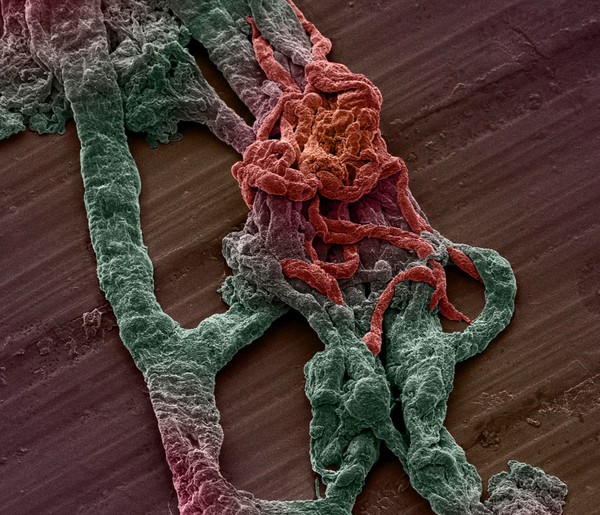Mouse brain capillaries, SEM