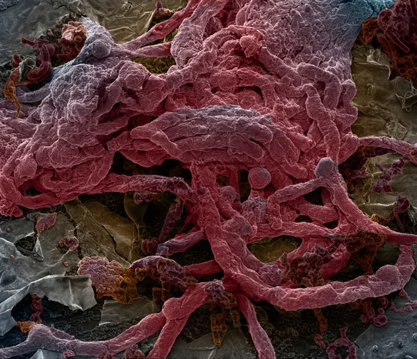 Mouse brain capillaries, SEM