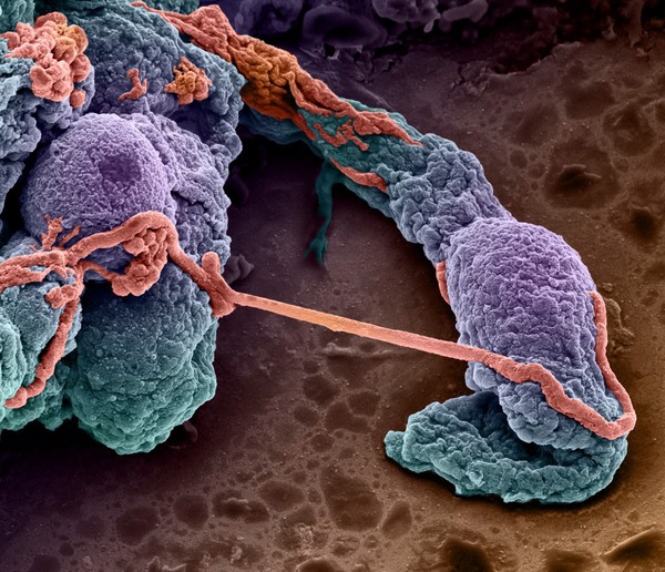 Mouse brain capillaries, SEM