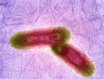 Nanographene oxide interacting with bacteria, TEM.