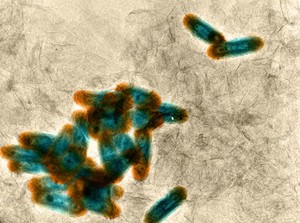 view Nanographene oxide interacting with bacteria, TEM