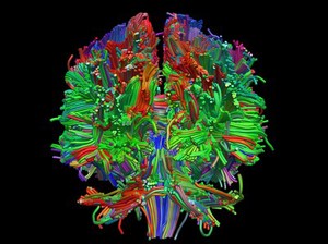 view Healthy adult human brain viewed face on, tractography