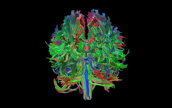 Healthy adult human brain viewed from behind, tractography