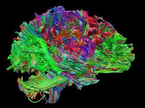 view Healthy adult human brain viewed from the side, tractography