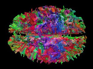 view Healthy adult human brain viewed from above, tractography