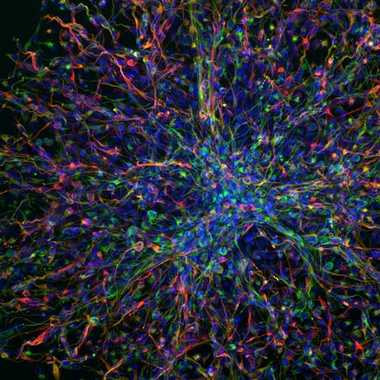 Highly invasive human paediatric brain tumour derived cells