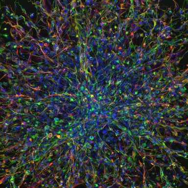 Highly invasive human paediatric brain tumour derived cells