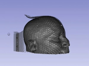 view Proton CT of a human head