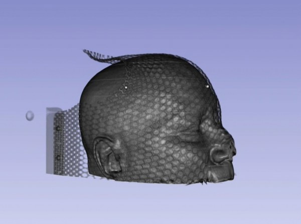 Proton CT of a human head