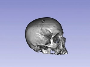 view Proton CT of a human skull