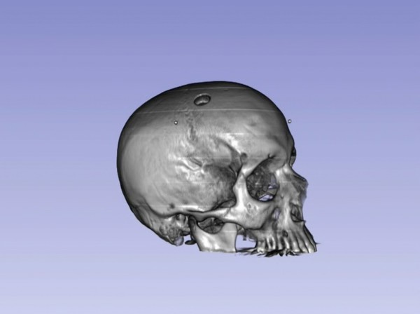 Proton CT of a human skull