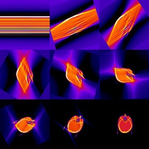 view Steps in producing a proton CT of a human phantom head