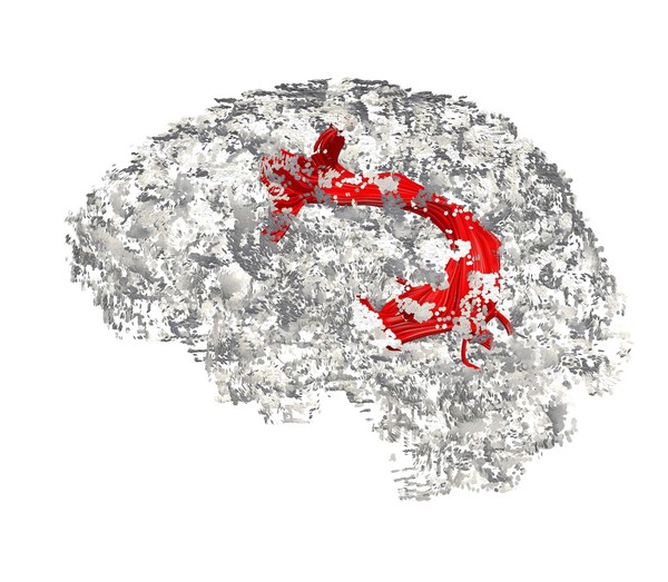 Processing language, left brain hemisphere (sagittal view)