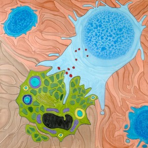 view St George and the dragon - T lymphocyte killing a cancer cell