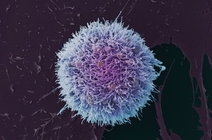 view HeLa cell, immortal human epithelial cancer cell line, SEM