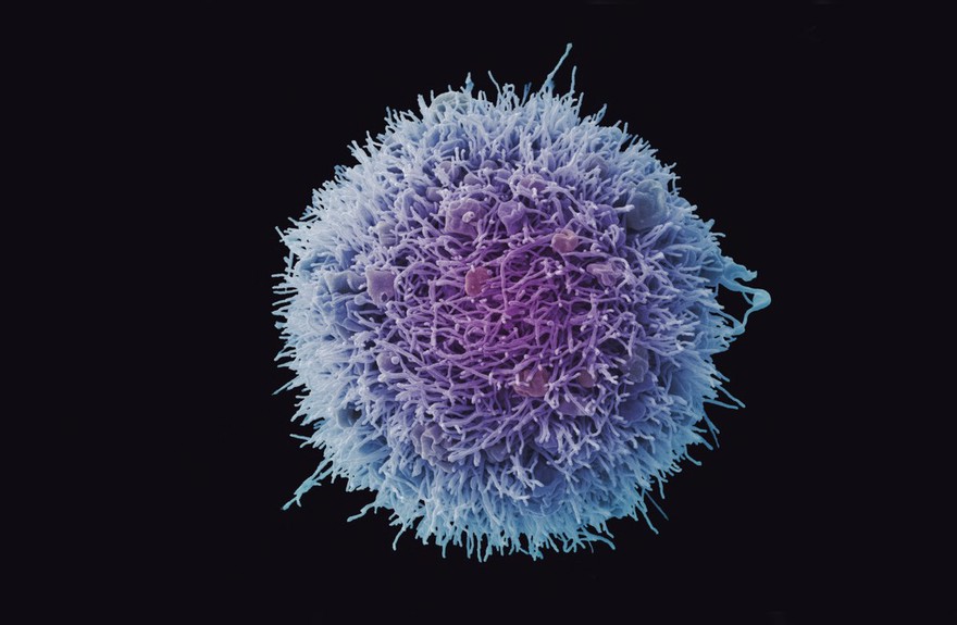 HeLa cell, immortal human epithelial cancer cell line, SEM