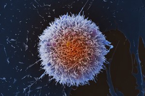 view HeLa cell, immortal human epithelial cancer cell line, SEM