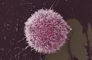 view HeLa cell, immortal human epithelial cancer cell line, SEM