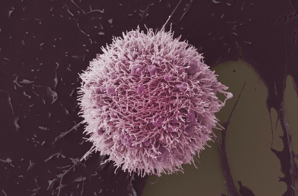 HeLa cell, immortal human epithelial cancer cell line, SEM