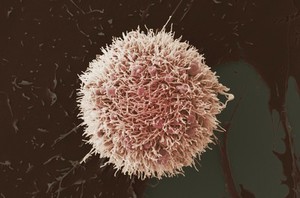 view HeLa cell, immortal human epithelial cancer cell line, SEM