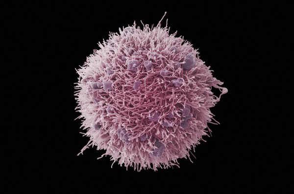 HeLa cell, immortal human epithelial cancer cell line, SEM