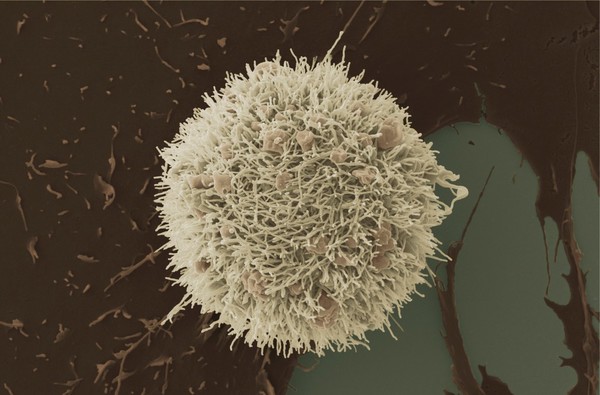 HeLa cell, immortal human epithelial cancer cell line, SEM