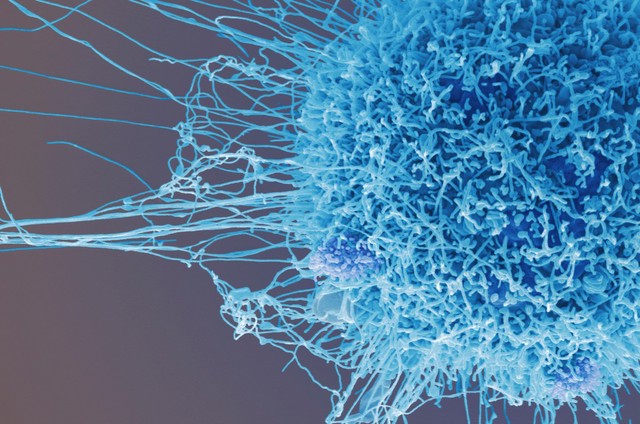 HeLa cell, immortal human epithelial cancer cell line, SEM