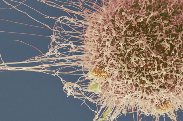 HeLa cell, immortal human epithelial cancer cell line, SEM