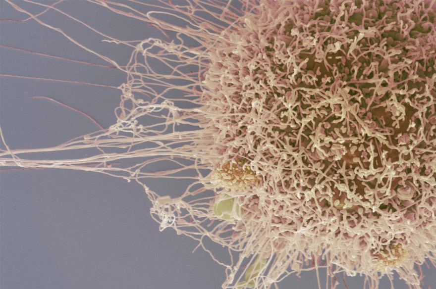 HeLa cell, immortal human epithelial cancer cell line, SEM