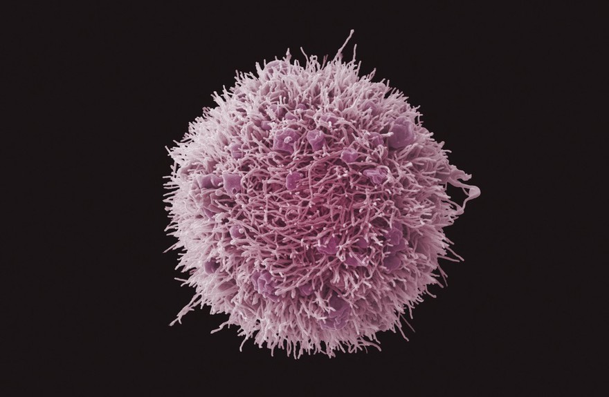 HeLa cell, immortal human epithelial cancer cell line, SEM