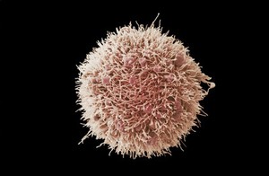 view HeLa cell, immortal human epithelial cancer cell line, SEM