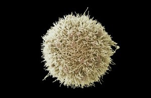 view HeLa cell, immortal human epithelial cancer cell line, SEM