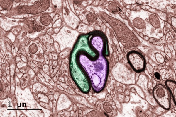 Myelinated nerves in a mouse brain, TEM