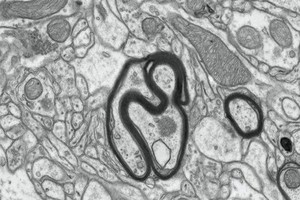 view Myelinated nerves in a mouse brain, TEM