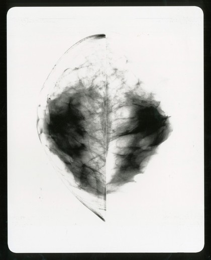 Healthy breast mammogram, artwork