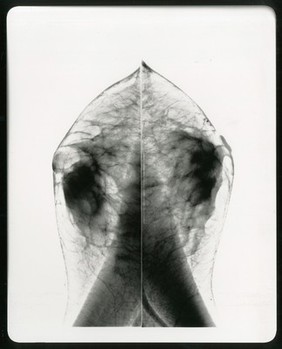 Healthy breast mammogram, artwork