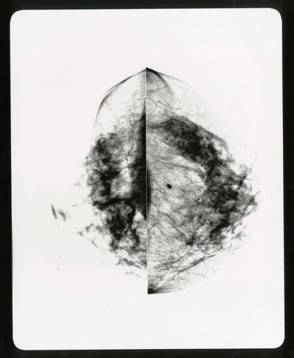 Healthy breast mammogram, artwork